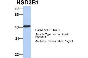 Host: Rabbit Target Name: HSD3B1 Sample Type: Human Adult Placenta Antibody Dilution: 1.