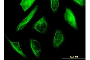 Immunofluorescence (IF) image for anti-Tubulin, alpha 1a (Tuba1a) (AA 352-451) antibody (ABIN521658)