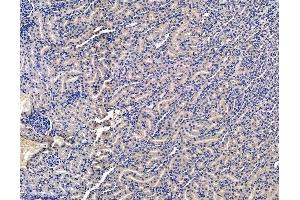 ABIN7095045 and ABIN7099101 at 1/100 staining rat kidney tissue by IHC-P.