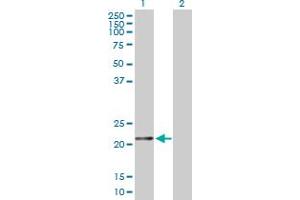 Western Blot analysis of FTH1 expression in transfected 293T cell line by FTH1 MaxPab polyclonal antibody. (FTH1 抗体  (AA 1-183))