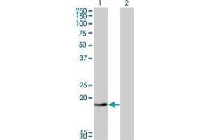 Western Blot analysis of DCTD expression in transfected 293T cell line by DCTD monoclonal antibody (M01), clone 4B9. (DCMP Deaminase (DCTD) (AA 69-178) 抗体)