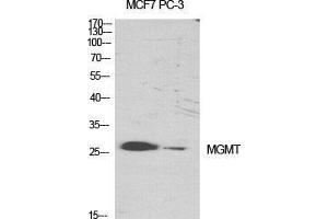 Western Blot (WB) analysis of specific cells using MGMT Polyclonal Antibody. (MGMT 抗体  (N-Term))
