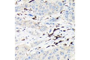 Immunohistochemistry (IHC) image for anti-Coronin, Actin Binding Protein, 1A (CORO1A) (AA 362-461) antibody (ABIN6138903)