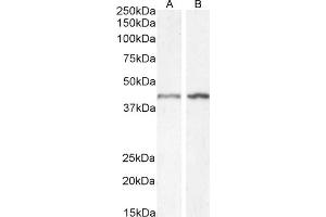 Western Blotting (WB) image for anti-Actin, alpha 2, Smooth Muscle, Aorta (ACTA2) (N-Term) antibody (ABIN185271)