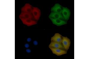 PIKFYVE Mouse Monoclonal Antibody staining Hela cells by IF/ICC. (PIKFYVE 抗体)