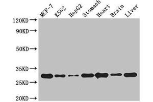 Western Blot Positive WB detected in: MCF-7 whole cell lysate, K562 whole cell lysate, HepG2 whole cell lysate, Mouse stomach tissue, Mouse heart tissue, Mouse brain tissue, Mouse liver tissue All lanes: RABGAP1L antibody at 3 μg/mL Secondary Goat polyclonal to rabbit IgG at 1/50000 dilution Predicted band size: 30, 93, 69, 95, 91, 44, 42, 43, 9 kDa Observed band size: 30 kDa (RABGAP1L 抗体  (Isoform 10))