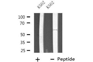 Western blot analysis of extracts from K562 cells, using PTGIS antibody. (PTGIS 抗体  (Internal Region))
