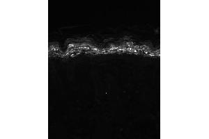 Immunohistochemistry (IHC) image for anti-Potassium Voltage-Gated Channel, Shaker-Related Subfamily, Member 5 (KCNA5) (C-Term) antibody (ABIN6658133)