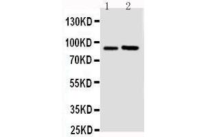 Anti-FGFR3 antibody, Western blotting Lane 1: U87 Cell Lysate Lane 2: SGC Cell Lysate (FGFR3 抗体  (N-Term))