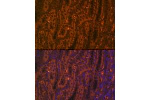 Immunofluorescence (IF) image for anti-Angiotensin I Converting Enzyme 2 (ACE2) (AA 18-250) antibody (ABIN6136429)