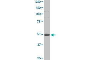 HD monoclonal antibody (M11), clone 3F1. (Huntingtin 抗体  (AA 81-190))