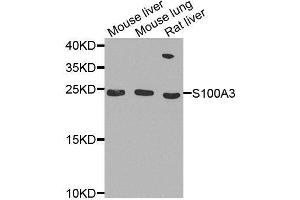 Western blot analysis of extracts of various cell lines, using S100A3 antibody. (S100A3 抗体  (AA 1-101))