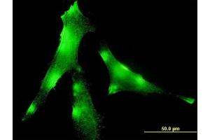 Immunofluorescence of monoclonal antibody to EVL on HeLa cell. (EVL 抗体  (AA 309-418))