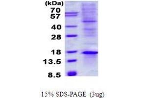 Image no. 1 for TGFB1-Induced Anti-Apoptotic Factor 1 (TIAF1) protein (His tag) (ABIN1098676) (TIAF1 Protein (His tag))