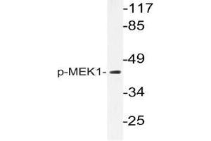Western blot (WB) analysis of p-MEK1 antibody in extracts from K562 cells. (MEK1 抗体  (pThr292))