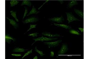 Immunofluorescence of monoclonal antibody to NPM2 on HeLa cell. (NPM2 抗体  (AA 1-214))