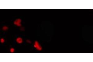 ABIN6274269 staining COLO205 cells by IF/ICC. (MEOX2 抗体  (Internal Region))