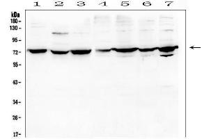 Western blot analysis of DARS2 using anti-DARS2 antibody (ABIN6719279).
