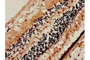 Immunohistochemistry (IHC) image for anti-Solute Carrier Family 32 (GABA Vesicular Transporter), Member 1 (SLC32A1) (AA 14-118) antibody (ABIN7175498)
