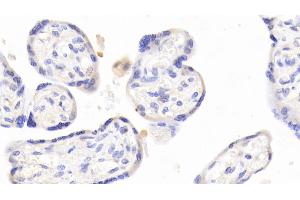 Immunohistochemistry (IHC) image for anti-Solute Carrier Family 39 (Zinc Transporter), Member 7 (SLC39A7) (AA 171-469) antibody (ABIN7445834)