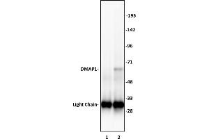 DMAP1 antibody (pAb) tested by Immunoprecipitation. (DMAP1 抗体  (C-Term))