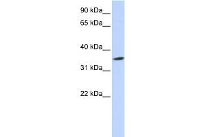 WB Suggested Anti-SEPT12 Antibody Titration: 0. (Septin 12 抗体  (Middle Region))