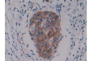 Immunohistochemistry (IHC) image for anti-Protein Kinase (CAMP-Dependent, Catalytic) Inhibitor beta (PKIB) (AA 8-76) antibody (ABIN7443077)