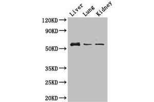 Western Blot Positive WB detected in: Mouse liver tissue, Mouse lung tissue, Mouse kidney tissue All lanes: MMP8 antibody at 3 μg/mL Secondary Goat polyclonal to rabbit IgG at 1/50000 dilution Predicted band size: 54 kDa Observed band size: 54 kDa (MMP8 抗体  (AA 22-283))