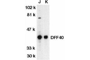 Western blot analysis of DFF40 in Jurkat (J) and K562 (K) whole cell lysate with AP30287PU-N DFF40 antibody at 1/500 dilution. (DFFB 抗体  (N-Term))