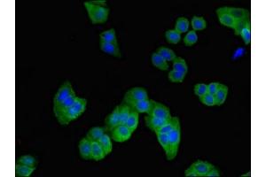 Immunofluorescent analysis of HepG2 cells using ABIN7167907 at dilution of 1:100 and Alexa Fluor 488-congugated AffiniPure Goat Anti-Rabbit IgG(H+L) (ARHGDIB 抗体  (AA 2-86))