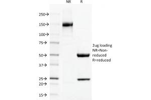 SDS-PAGE (SDS) image for anti-Thrombomodulin (THBD) (AA 69-194) antibody (ABIN6940727)