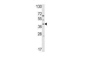 Western blot analysis of hRai3- (ABIN390176 and ABIN2840668) in T47D cell line lysates (35 μg/lane). (GPRC5A 抗体  (C-Term))