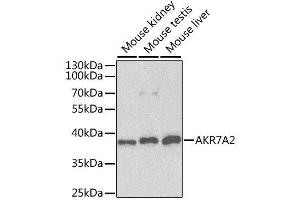 Western blot analysis of extracts of various cell lines, using AKR7A2 antibody. (AKR7A2 抗体  (AA 100-359))