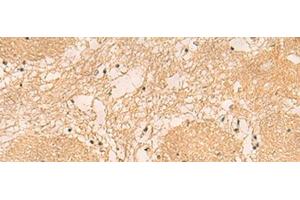 Immunohistochemistry of paraffin-embedded Human brain tissue using EMC1 Polyclonal Antibody at dilution of 1:40(x200) (KIAA0090 抗体)