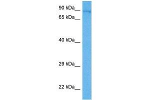 Host:  Mouse  Target Name:  HNRNPU  Sample Tissue:  Mouse Liver  Antibody Dilution:  1ug/ml (HNRNPU 抗体  (N-Term))