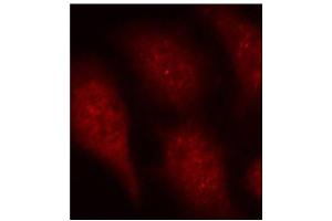 Immunofluorescence staining of methanol-fixed HeLa cells using Phospho-CDK6-Y24 antibody (ABIN2987839). (CDK6 抗体  (pTyr24))