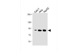 Western Blotting (WB) image for anti-ATG7 Autophagy Related 7 (ATG7) (AA 540-569), (C-Term) antibody (ABIN388523)