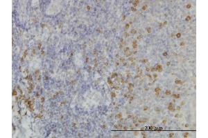 Immunoperoxidase of monoclonal antibody to SSR1 on formalin-fixed paraffin-embedded human tonsil. (SSR1 抗体  (AA 33-286))