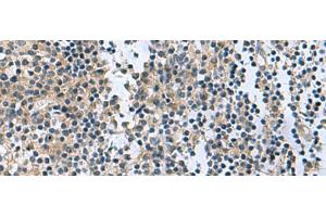 Immunohistochemistry of paraffin-embedded Human tonsil tissue using RGS2 Polyclonal Antibody at dilution of 1:95(x200) (RGS2 抗体)
