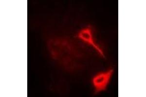 Immunofluorescent analysis of HAS3 staining in A549 cells. (HAS3 抗体)