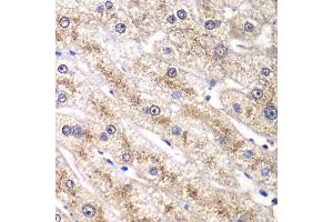 Immunohistochemistry of paraffin-embedded human liver injury using RALB antibody at dilution of 1:100 (x40 lens). (RALB 抗体)