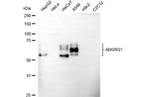Western blotting analysis using ADGRG1 antibody (ABIN7798673).