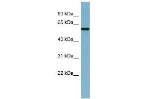 CAP1 antibody used at 1 ug/ml to detect target protein. (CAP1 抗体)