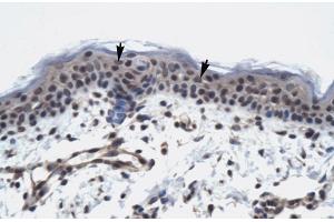Immunohistochemistry (IHC) image for anti-RNA Polymerase II TBP-Associated Factor Subunit G (TAF9) (N-Term) antibody (ABIN2775865)