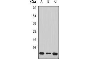 Western blot analysis of PC4 expression in HL60 (A), Jurkat (B), mouse brain (C) whole cell lysates. (SUB1 抗体)