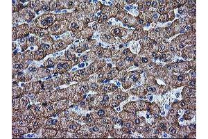 Immunohistochemical staining of paraffin-embedded Human liver tissue using anti-ARG1 mouse monoclonal antibody. (Liver Arginase 抗体)