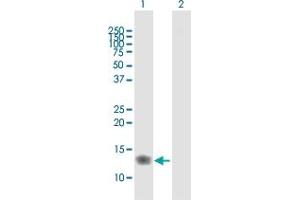 IFITM3 antibody  (AA 1-133)
