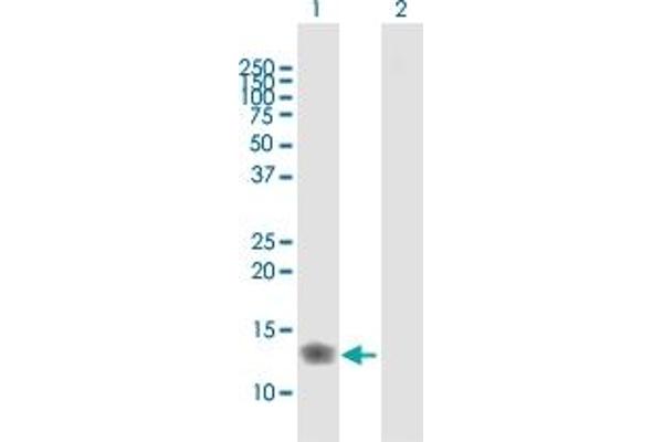 IFITM3 Antikörper  (AA 1-133)