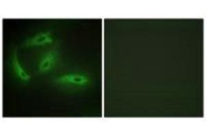 Immunofluorescence analysis of HeLa cells, using CDKL4 antibody. (CDKL4 抗体  (C-Term))