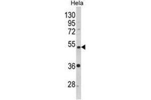 Western blot analysis of PPP2R2B Antibody (Center) in Hela cell line lysates (35ug/lane). (PPP2R2B 抗体  (AA 110-139))